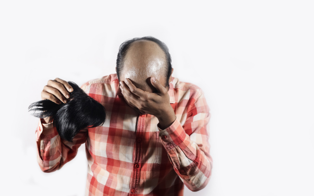 Calling Men “Bald” Is now considered Sexual Harassment